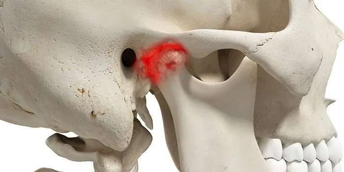 roi-loan-khop-thai-duong-ham-4