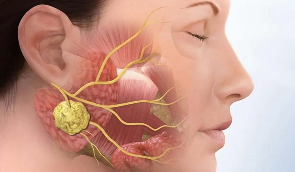 cat-bo-khoi-u-xuong-ham-1