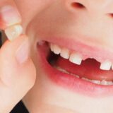 Dấu Hiệu Nhận Biết Trẻ Đang Thay Răng