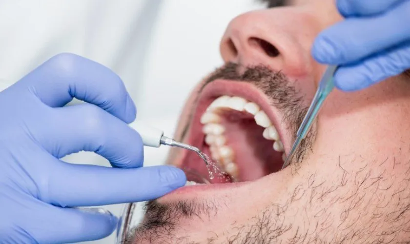 lấy cao răng có hại gì không