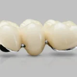 mão sứ